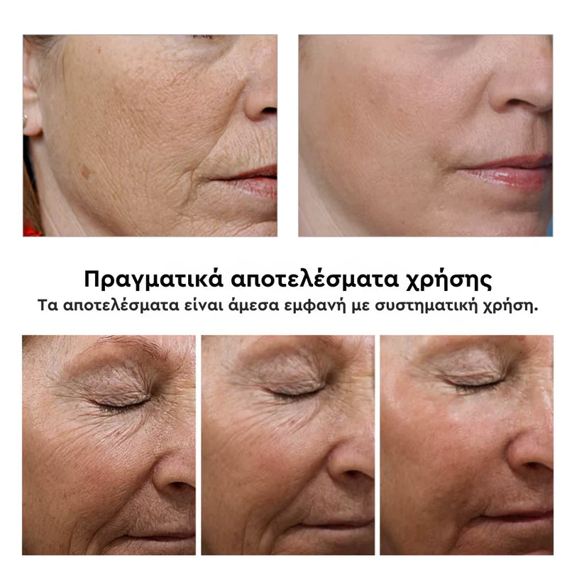 Mamushi ARG® Cream 50ml - Botox Effect Κρέμα με Argireline