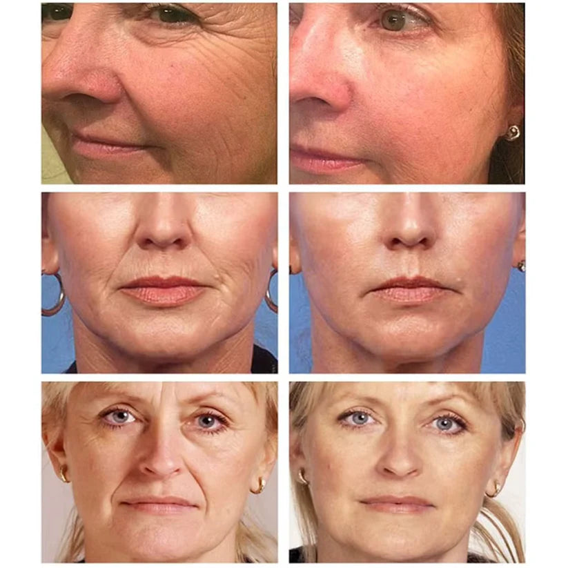 Mamushi ARG® Cream 50ml - Botox Effect Κρέμα με Argireline